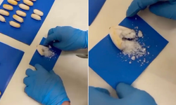 Midesinden onlarca uyuşturucu paketi çıktı