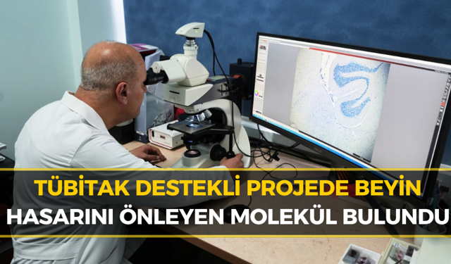 Karabük Üniversitesinden Alzheimer Tedavisinde Büyük Buluş