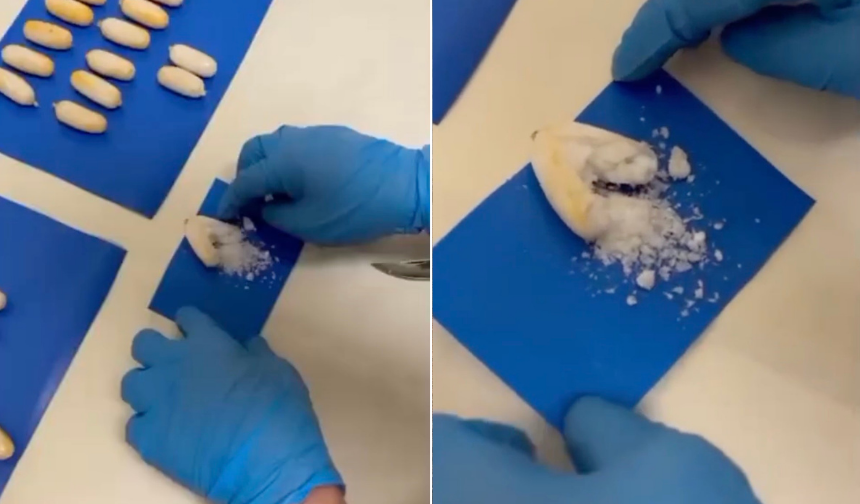 Midesinden onlarca uyuşturucu paketi çıktı