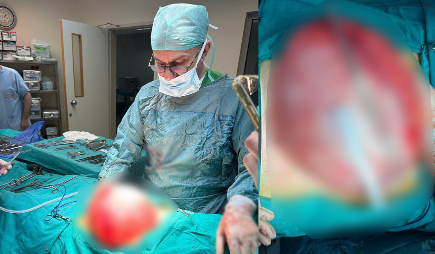 Kilo Verme Hayaliyle Giden Gencin Karnından Bakın Ne Çıktı